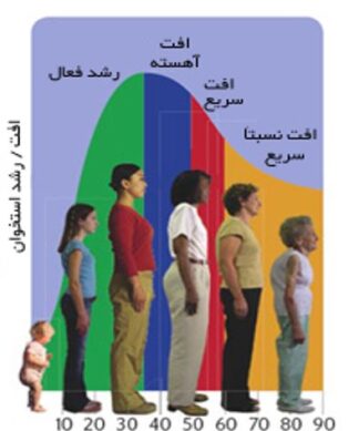 تمرینات ورزشی تقویت استخوان و درمان پوکی استخوان