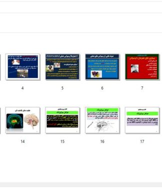 اﺧﺘﻼل وﺳﻮاﺳﯽ - جبری