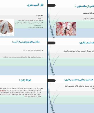 آسیب مغزی