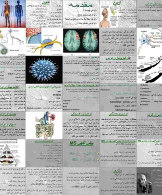 ام اس MS