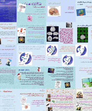 سکته مغزی