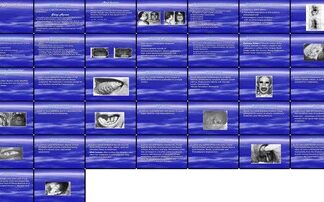 Sleep Disorders and Oral Cavity Lesions