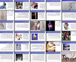 دانلود پاورپوینت آسیب‌های ورزشی سر، گردن، کتف، پشت، ران، کشاله ران، زانو، ساق پا