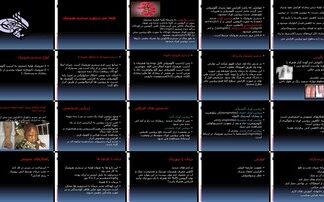 دانلود پاورپوینت سندرم نفروتیک علائم، علل، تشخیص، انواع (اولیه، ثانویه، مادرزادی)، درمان (کورتون،