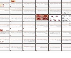 دانلود پاورپوینت شکاف لب و شکاف کام علل، تشخیص، درمان جراحی، مراقبت های پرستاری