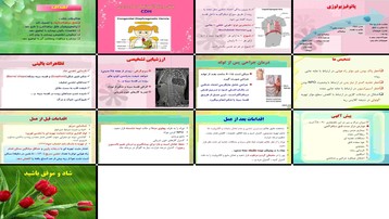 دانلود پروژه بررسی فتق دیافراگماتیک مادرزادی تشخیص درمان و مراقبت پرستاری