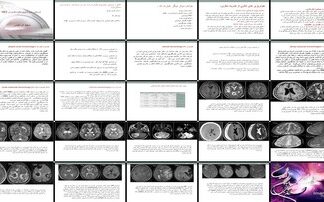 دانلود پروژه بررسی و ارزیابی خونریزی مغزی در MRI بر اساس زمان و محل