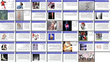 دانلود پروژه بررسی و تحلیل انواع آسیب‌های ورزشی سر گردن کتف پشت ران زانو