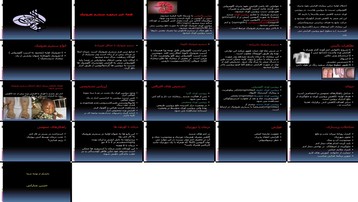 دانلود پروژه بررسی و تحلیل سندرم نفروتیک در کودکان علل تشخیص درمان و عوارض