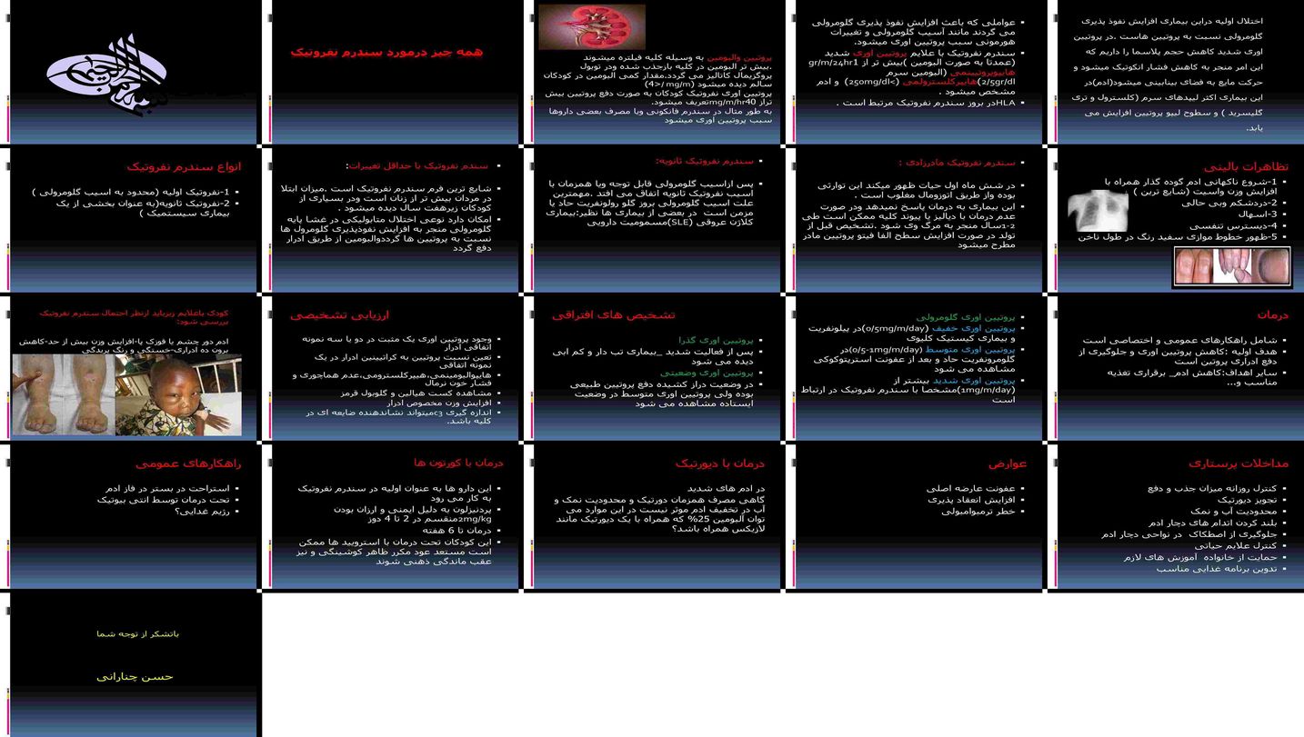 دانلود پروژه بررسی و تحلیل سندرم نفروتیک در کودکان علل تشخیص درمان و عوارض