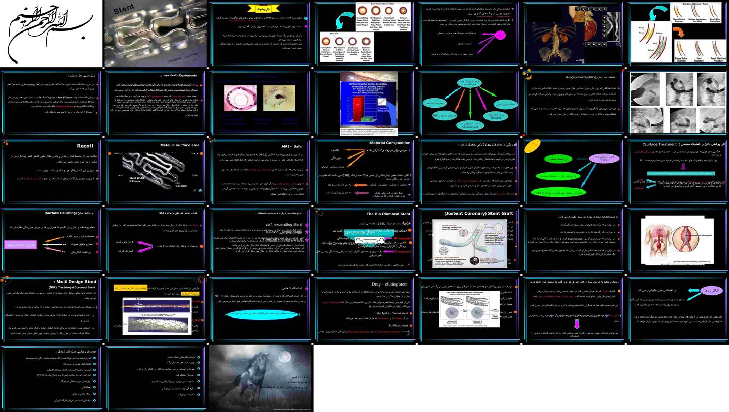 دانلود پروژه بررسی و تحلیل نقش استنت در درمان تنگی عروق خونی
