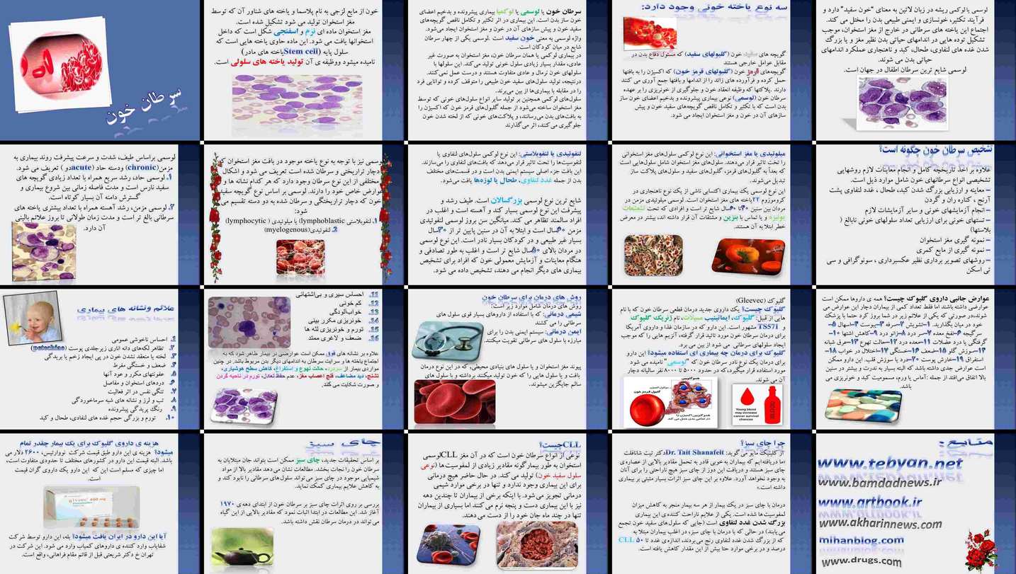 دانلود پروژه بررسی و تحلیل نقش چای سبز در درمان سرطان خون (لوسمی)