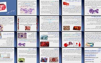 دانلود پروژه بررسی و تحلیل نقش چای سبز در درمان سرطان خون (لوسمی)