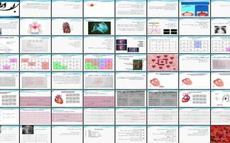 دانلود پروژه بررسی پاتوفیزیولوژی تشخیص عوارض و درمان انفارکتوس میوکارد مطالعه جامع