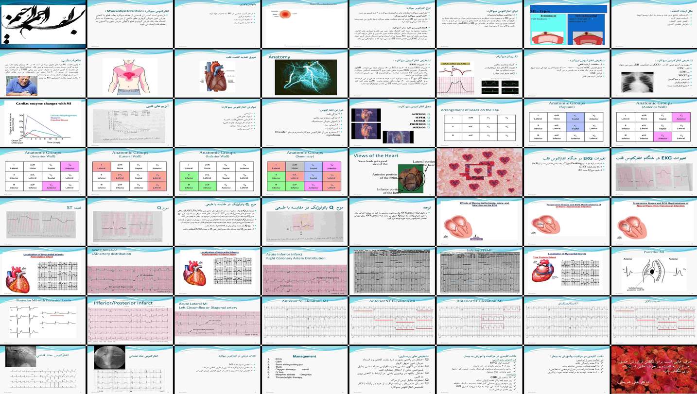 دانلود پروژه بررسی پاتوفیزیولوژی تشخیص عوارض و درمان انفارکتوس میوکارد مطالعه جامع