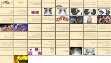 دانلود پروژه مطالعه COPD و نارسایی حاد تنفسی علل تشخیص و درمان دانلود پروژه مطالعه COPD و نارسایی حاد تنفسی علل تشخیص و درمان